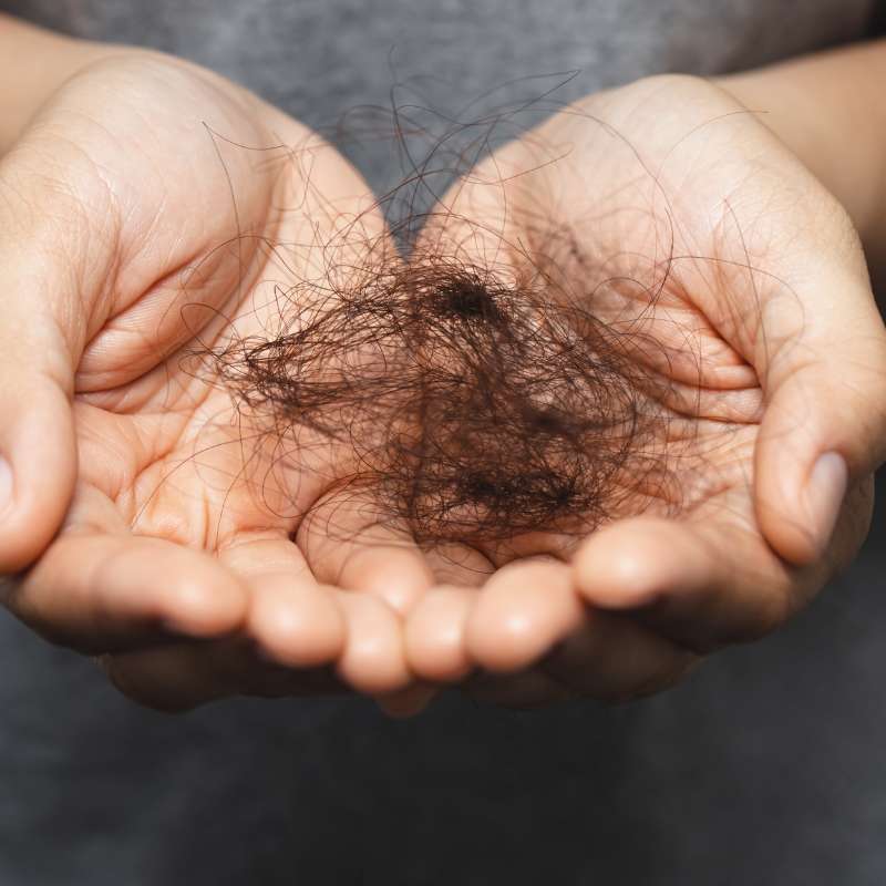 Prevenir Caída Cabello